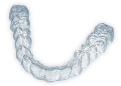 invisalign-for-adults.jpg