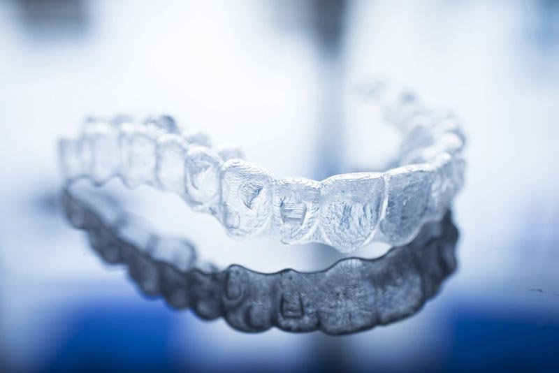 invisalign-gapped-teeth.jpg