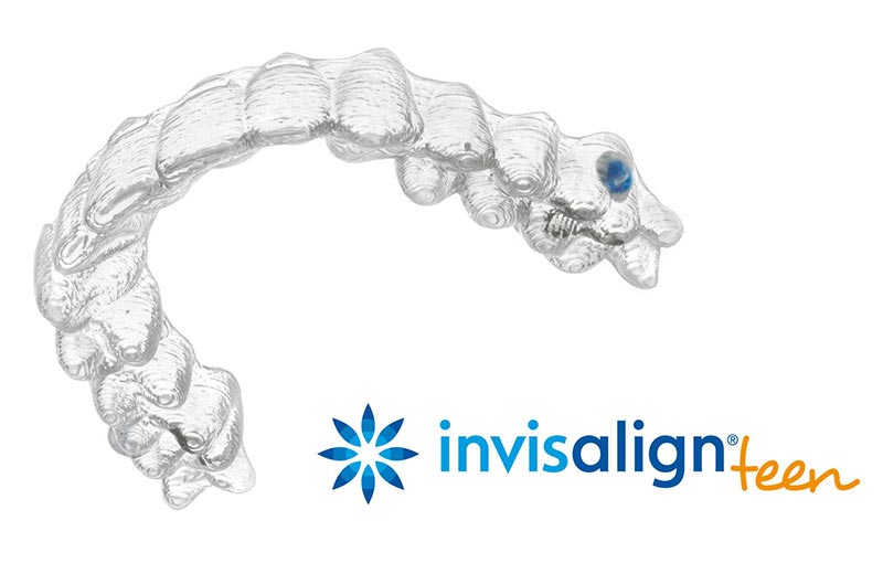 invisalign-teens.jpg